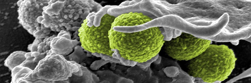 Drug-resistant Staphylococcus Aureus (MRSA) bacteria. Photo: National Institute of Health (Wikipedia/Flickr/Creative Commons)